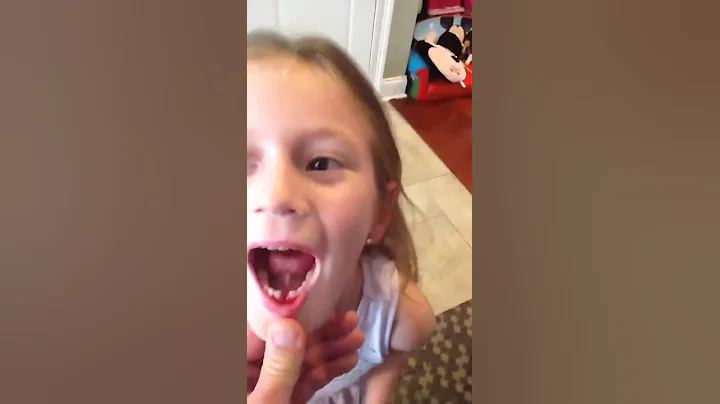 Lily's first experimental tooth removal!