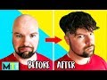 Men Try Non-Surgical Hair Replacements &amp; Wigs - Before and After!