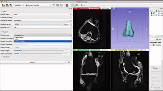 aevaSlicer: Screen Capture