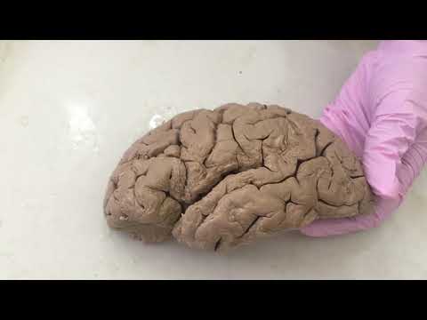видео: Головной мозг. Борозды, извилины
