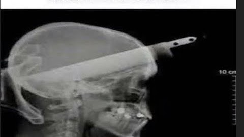 Rayman Legends: 5-2 Segmented Speedrun in 1:10.xx (Improved)