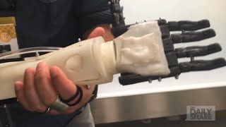 Watch: 3-D printers make prosthetics for Sudanese
