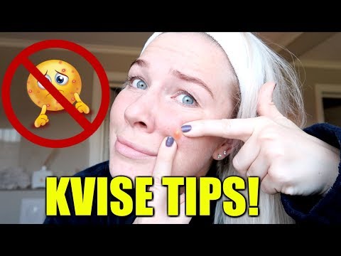 KVISE TIPS! Beste måten og bli kvitt dem på!