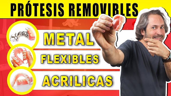 ✅ Tipos 𝗱𝗲 𝗣𝗥𝗢𝗧𝗘𝗦𝗜𝗦 𝗗𝗘𝗡𝗧𝗔𝗟𝗘𝗦 𝗥𝗘𝗠𝗢𝗩𝗜𝗕𝗟𝗘𝗦 : Ventajas e Inconvenientes ¿Que Dentadura Postiza es MEJOR?