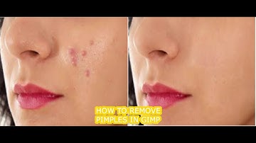 HOW TO REMOVE PIMPLE IN GIMP