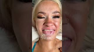 Disabled Bodies Are Beautiful