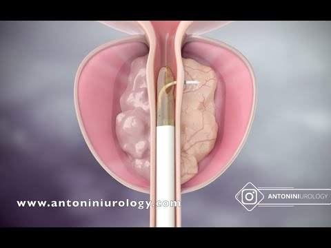 Video: Anatomia, Funzione E Posizione Della Prostata - Body Maps