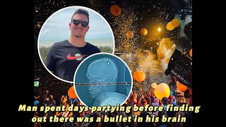 Man spent days partying before finding out there was a bullet in his brain by Taxo 30 views 2 months ago 2 minutes, 6 seconds