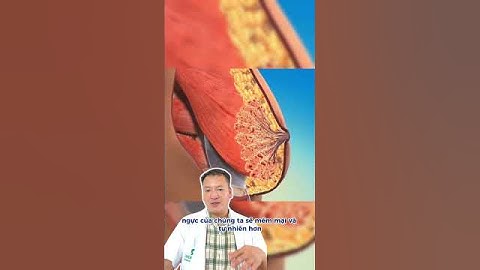 Nâng ngực xong có bị cứng, giả và mất tự nhiên không #nangvong1 #nangcapvong1 #nangnguc