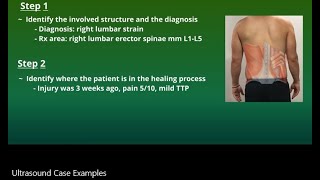 Physical Therapy Ultrasound Case Examples