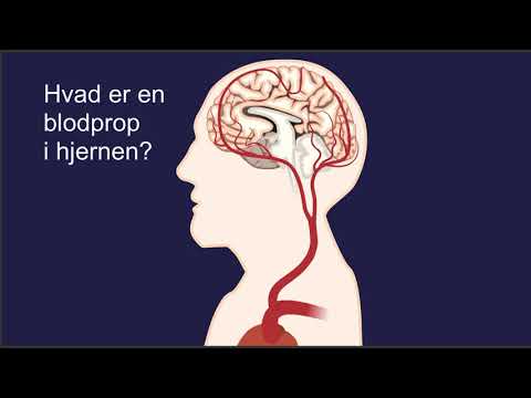 Video: Hvad Er Forskellen Mellem En Hjerneinfarkt Og Et Slagtilfælde: Hvad Er Det, Tegn