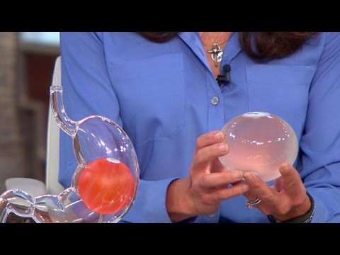 New balloon capsule could take bite out of obesity