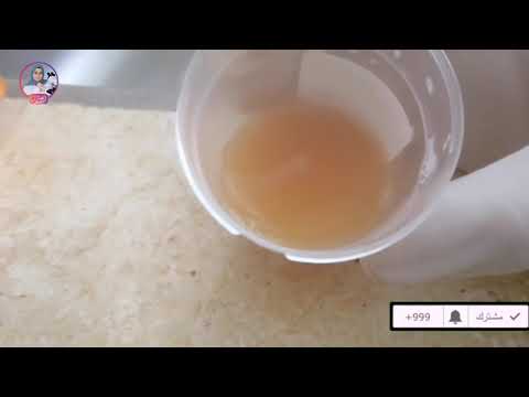 فحص عينة بول بها عكاره       