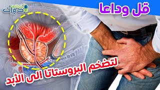 هل يعود الانتصاب بعد علاج البروستاتا/بروستاتا/علاج فعال للبروستاتا/علاج طبيعي للبروستاتا