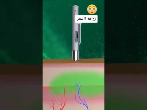 كيف تتم عملية زراعة شعر