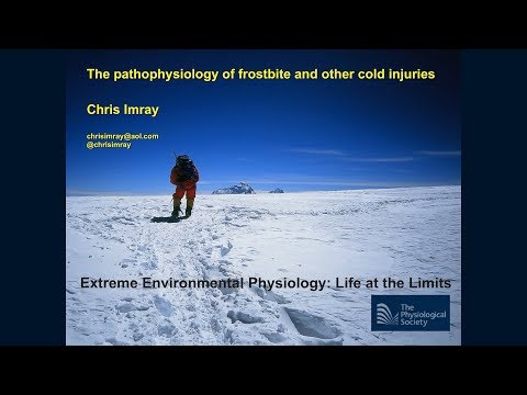 Video: Frostbite: What Is And How It Happens - Alternative View