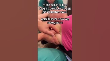 Shoulder Pain Won’t Go Away? Get Subscapularis Checked For Adhesion!