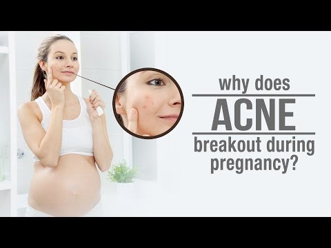 why does acne breakout during pregnancy ?