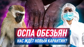 Дойдет ли до Кыргызстана обезьянья оспа?