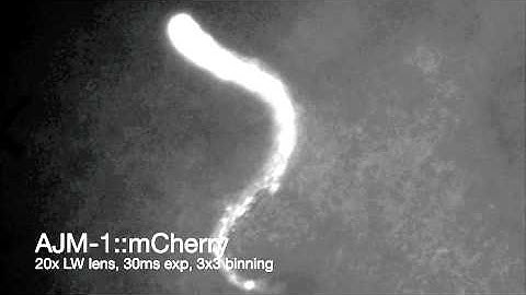 Kramer Scientific C. Elegans Video Taken On An FBS10