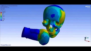 1st in the World!!! ANSYS WB Static Structural FEA - Boxing punch of plastic skull with mouth guard