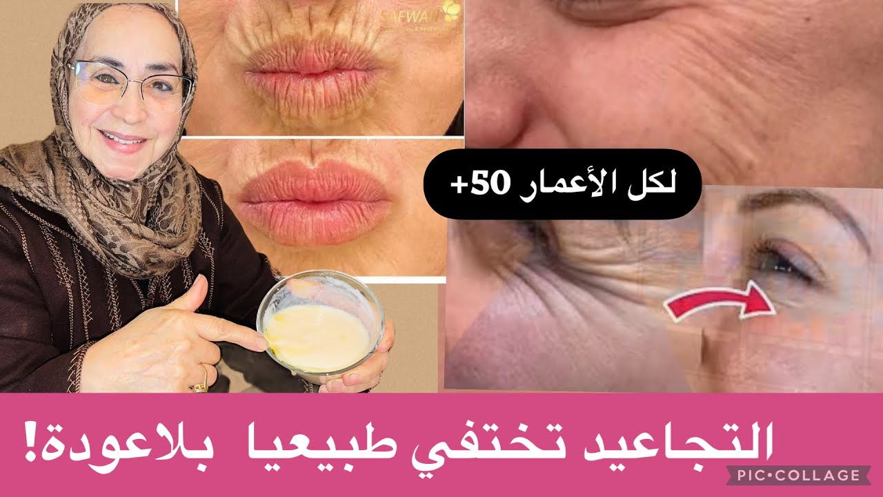 التجاعيد تختفي طبيعياً بلا عودة | طريقة بسيطة لكلّ الأعمارحتى لو في 60 سنة النتيجة كتبان