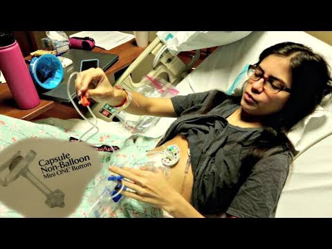 Venting My New G Tube Amt Non Balloon Button 11718