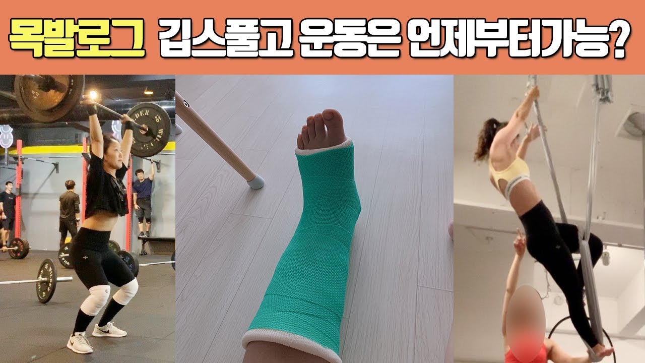 목발로그 | 깁스풀고 운동은 언제부터 가능할까요? | 재활운동 | 깁스풀기 | 깁스하고 샤워하기 |
