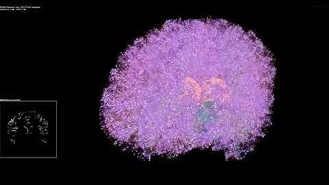 Artificial Brain Simulation   Thalamocortical System, 8 Million Neurons   1 4 Billion Synapses