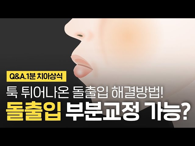 돌출입 부분교정으로도 가능!? 돌출 앞니교정 부분치아교정 어디까지!? ⏰1분 치아상식!!