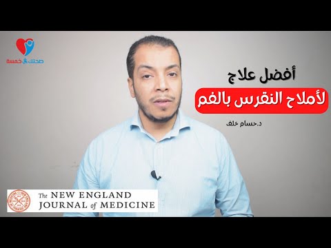 علاج املاح النقرس زيلوريك افضل ولافيبيوريك
