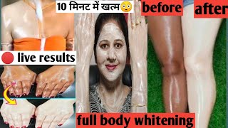 जादुई pack सालों साल पुराना जिद्दी कालापन एक ही बार में साफskin ka kalapan Dur Karen,body whitening