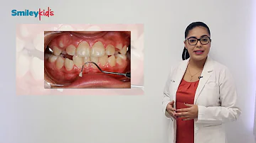 ¿La falta de dientes es genética?