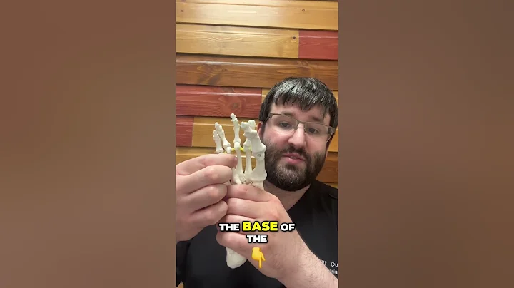 Understanding Morton's Neuroma: Causes, Symptoms, and Treatment