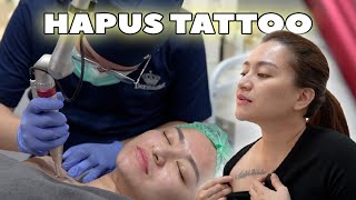 HAPUS TATTOO LAGI