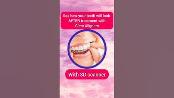 Transform Your Smile with Clear Aligners: Visualize Your Perfect Teeth with AI | Dr. Srishti Bhatia