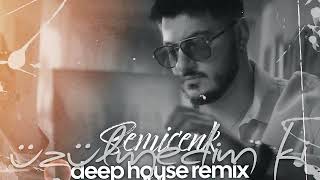 Semicenk - Üzülmedim Ki I Deep House Remix