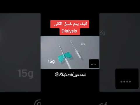 كيف يتم عملية غسيل الكليه