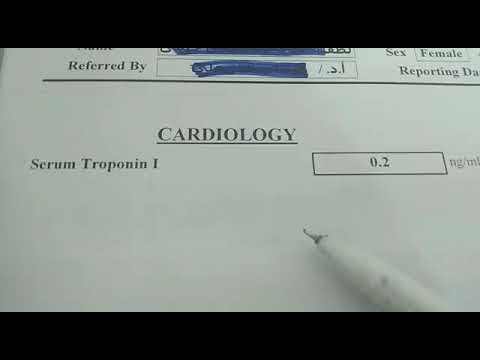 قراءة تحليل تروبونين Troponin iوعلاقتة بالازمات القلبية ؟ مرتبط بزيادة خطر الموت ؟