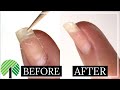 Fix a Broken Nail with Household Items! | Nail Repair Hack WITHOUT a Tea Bag