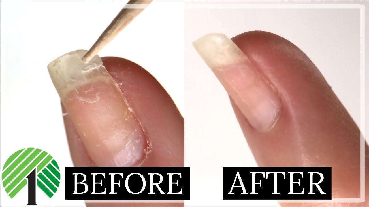 Can a nail salon fix a broken natural nail? - Hello Betty Company