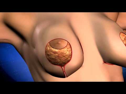 Male fisting tgp Alyssa milano breasts