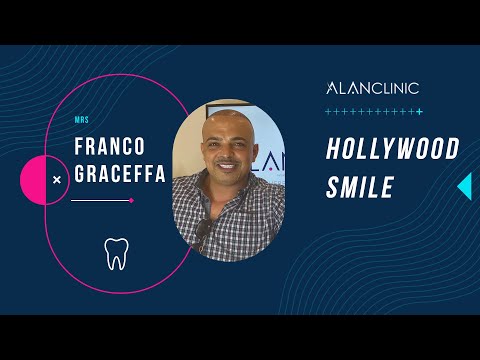 Alan Clinic : Mr Franco Graceffa traveled from belgium to get a Hollywood Smile in Turkey