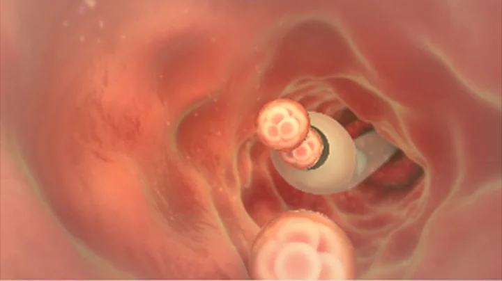 Embryo Transfer  | Santa Monica Fertility - DayDayNews