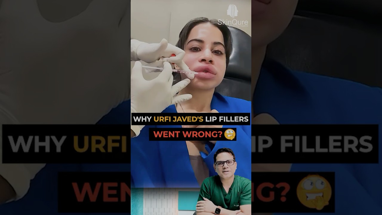 Urfi Javed ka look totally badal gaya! Lip fillers ka sach aaya saamne | dr. Jangid