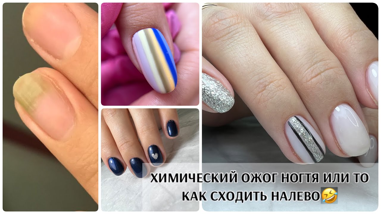 ХИМИЧЕСКИЙ ОЖОГ ногтя😢клиентка сходила НАЛЕВО😏ХРОНИКА на клиенте💖 ...