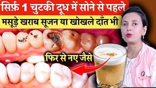 सिर्फ़ 1 चुटकी दूध में सोने से पहले, मसूड़े में सूजन, कीड़ा लगा , खोखला दांत भी नया | Teeth Cavity