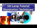 Slit Lamp Exam Tutorial - Part 2 | Illumination Techniques Mp3 Song