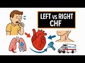 Congestive Heart Failure Made Simple for NREMT