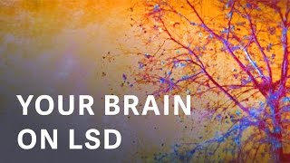 The first modern images of a human brain on LSD